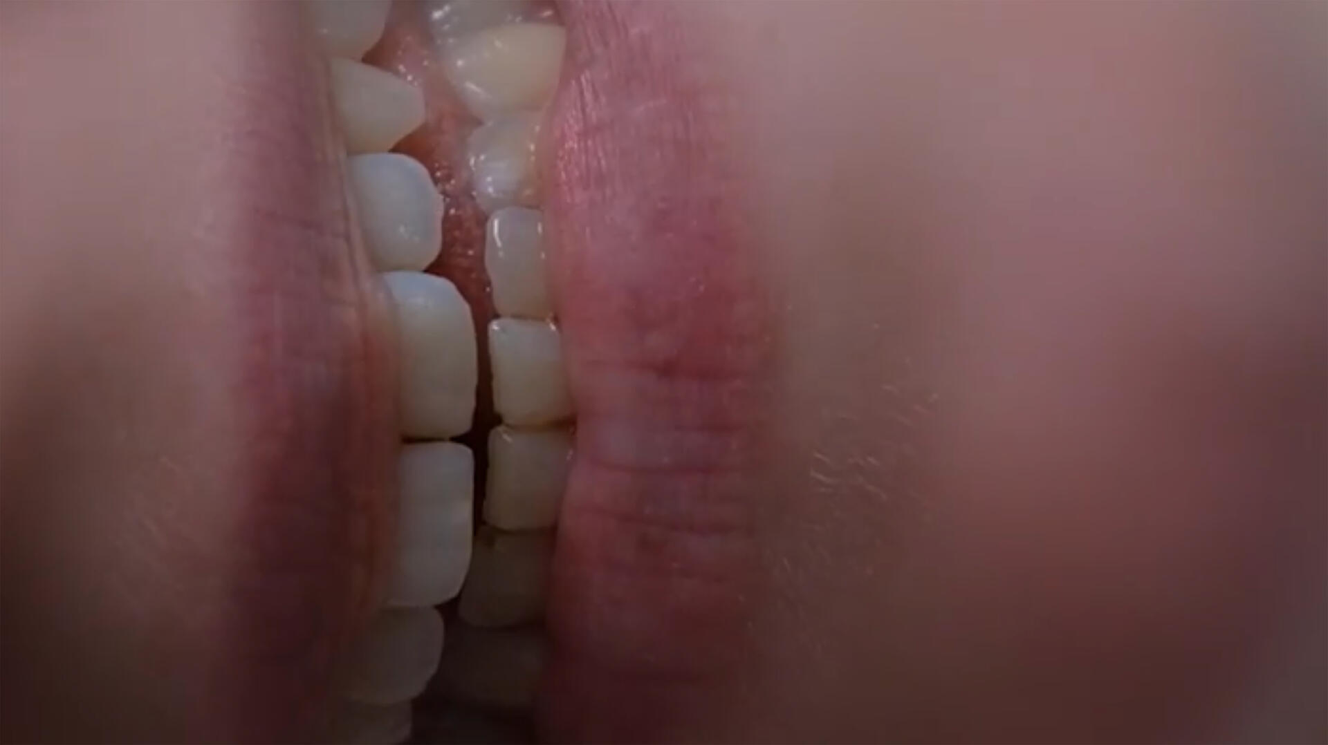 Mouthnotes.jpg